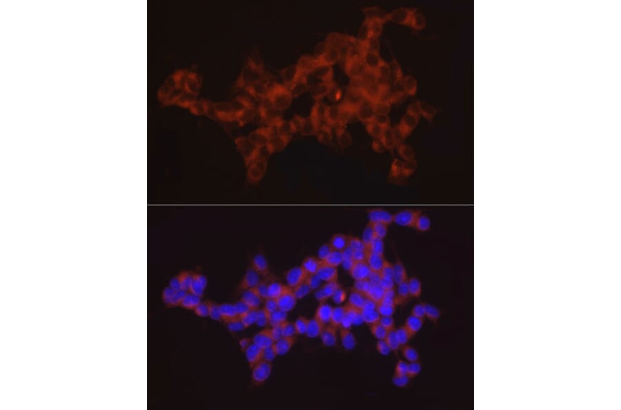 Immunofluorescence - Anti-SYT11 Antibody (A16111) - Antibodies.com