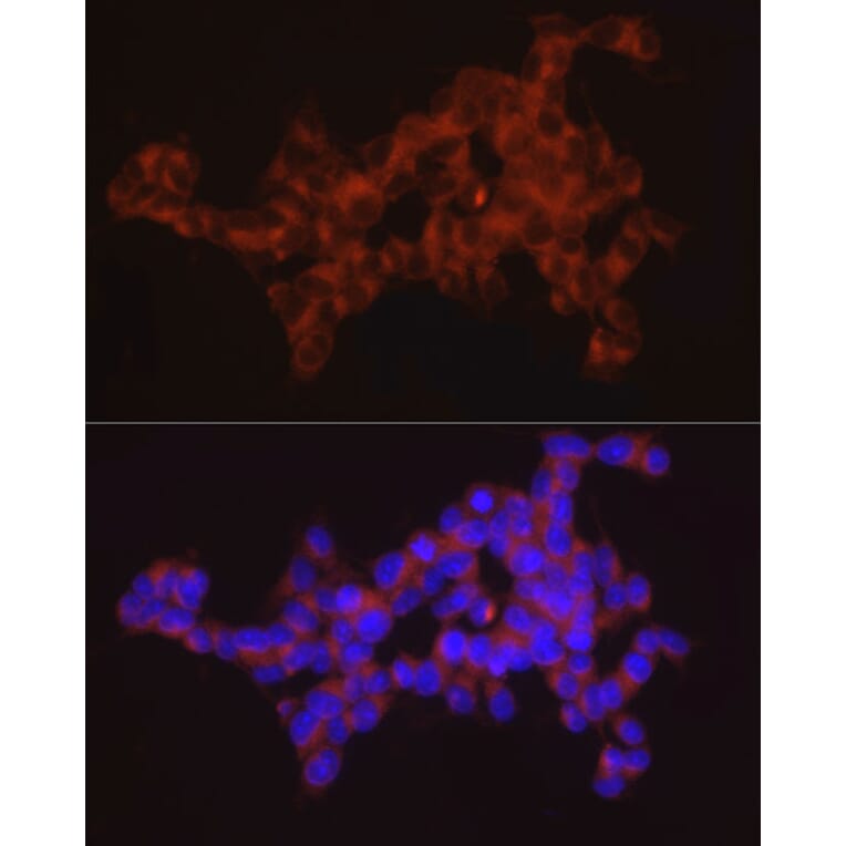 Immunofluorescence - Anti-SYT11 Antibody (A16111) - Antibodies.com