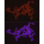 Immunofluorescence - Anti-SYT11 Antibody (A16111) - Antibodies.com