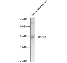 Western Blot - Anti-DAPK2 Antibody (A16112) - Antibodies.com