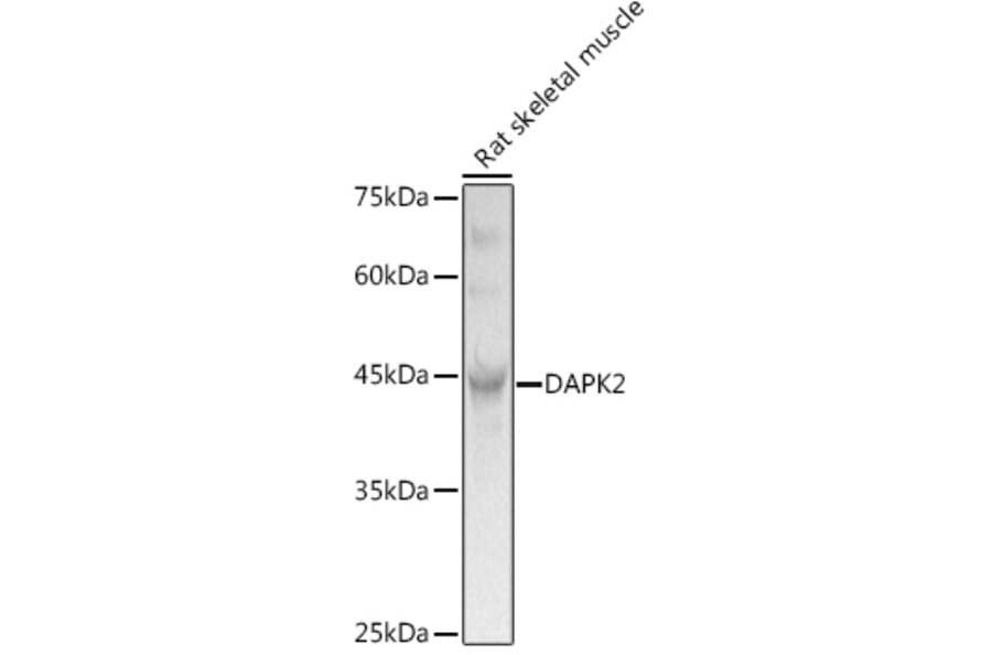 Western Blot - Anti-DAPK2 Antibody (A16112) - Antibodies.com
