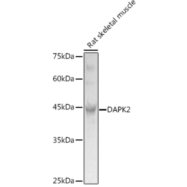 Western Blot - Anti-DAPK2 Antibody (A16112) - Antibodies.com