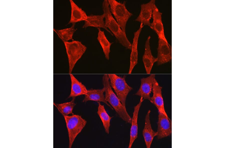 Immunofluorescence - Anti-DAPK2 Antibody (A16112) - Antibodies.com