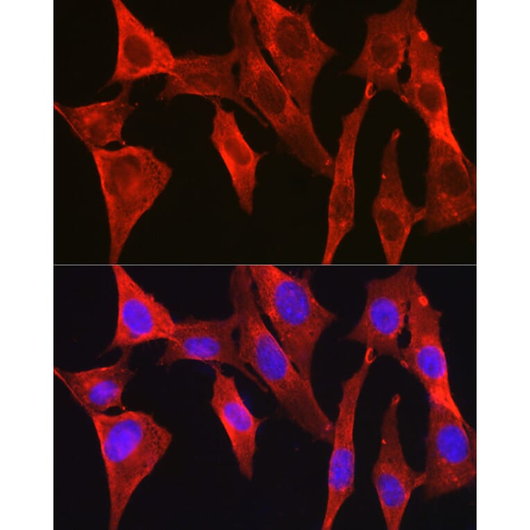 Immunofluorescence - Anti-DAPK2 Antibody (A16112) - Antibodies.com