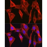 Immunofluorescence - Anti-DAPK2 Antibody (A16112) - Antibodies.com