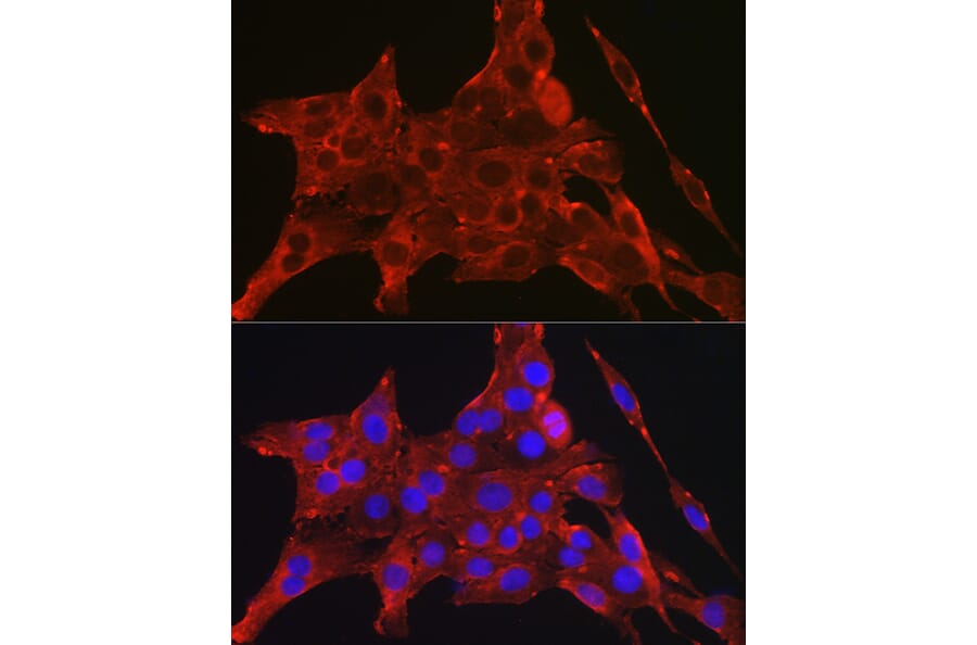 Immunofluorescence - Anti-DAPK2 Antibody (A16112) - Antibodies.com