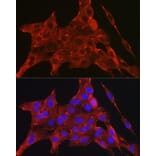 Immunofluorescence - Anti-DAPK2 Antibody (A16112) - Antibodies.com