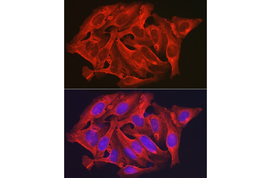 Immunofluorescence - Anti-DAPK2 Antibody (A16112) - Antibodies.com