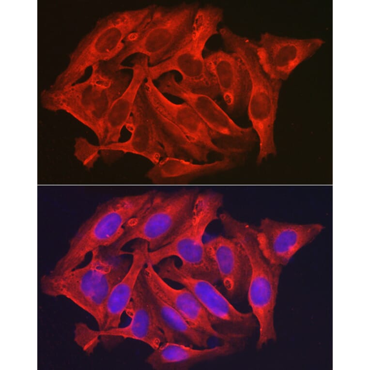 Immunofluorescence - Anti-DAPK2 Antibody (A16112) - Antibodies.com