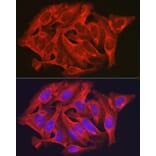 Immunofluorescence - Anti-DAPK2 Antibody (A16112) - Antibodies.com