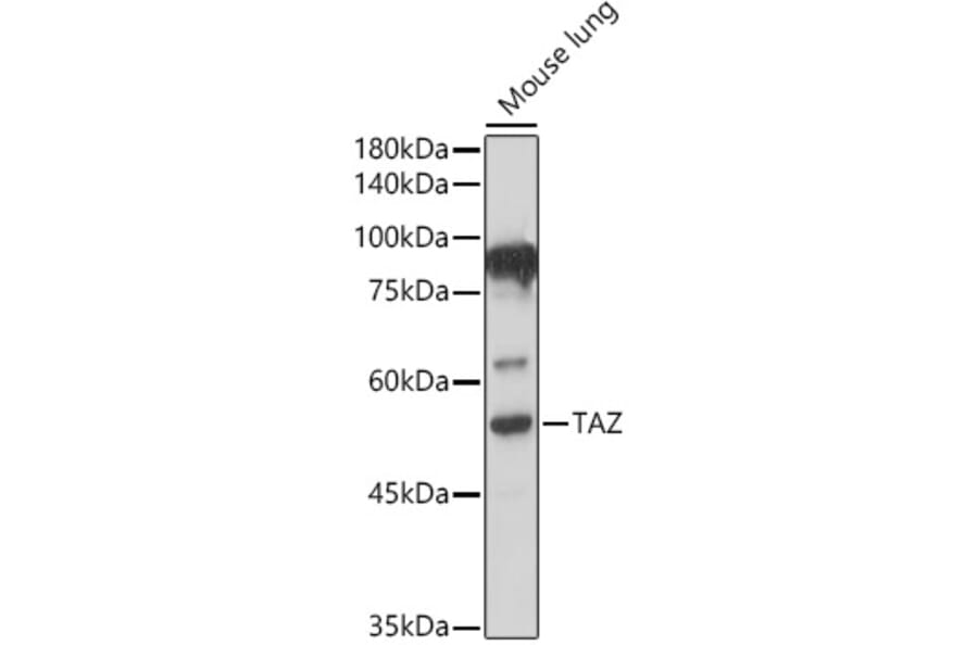 Western Blot - Anti-TAZ Antibody (A16113) - Antibodies.com