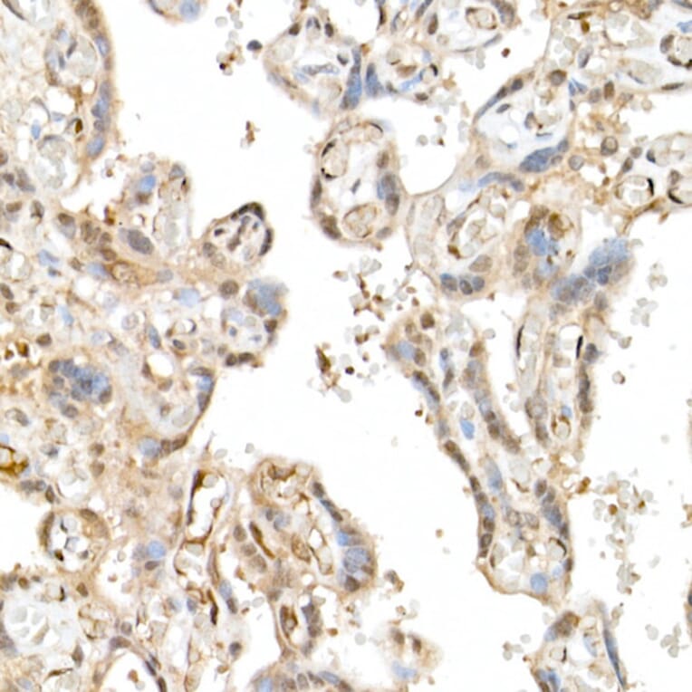 Immunohistochemistry - Anti-TAZ Antibody (A16113) - Antibodies.com