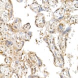 Immunohistochemistry - Anti-TAZ Antibody (A16113) - Antibodies.com