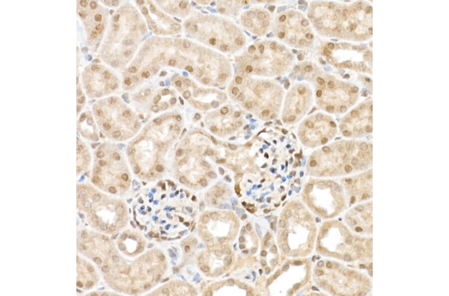 Immunohistochemistry - Anti-TAZ Antibody (A16113) - Antibodies.com