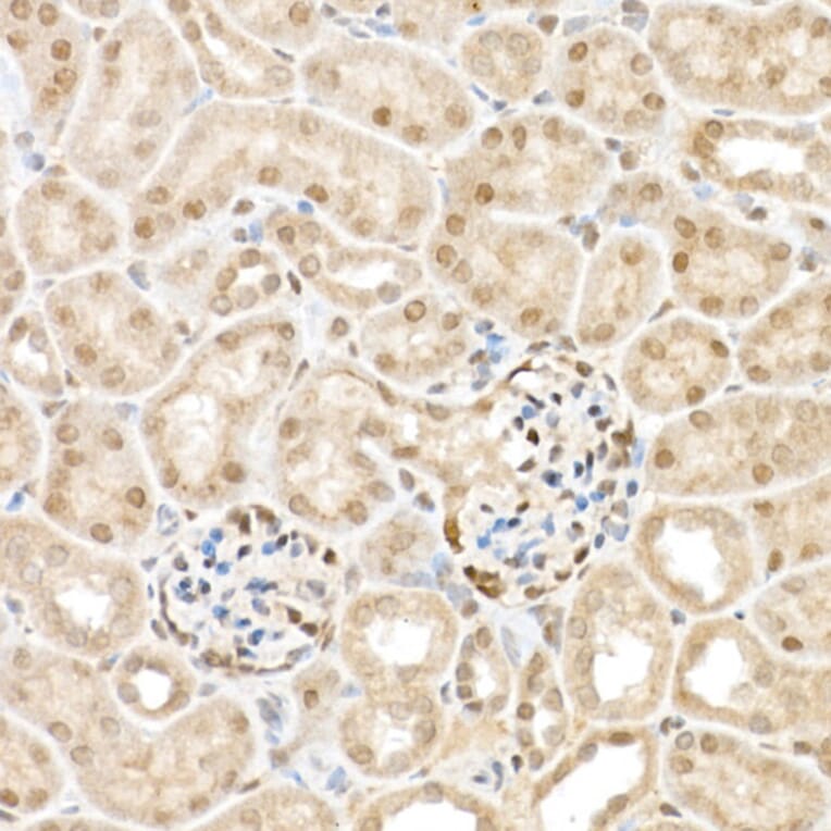 Immunohistochemistry - Anti-TAZ Antibody (A16113) - Antibodies.com