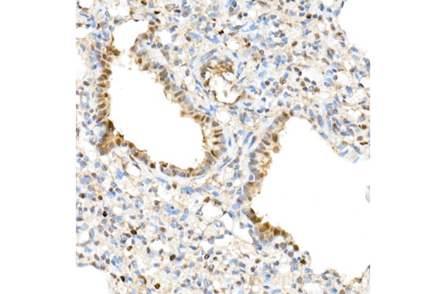 Immunohistochemistry - Anti-TAZ Antibody (A16113) - Antibodies.com