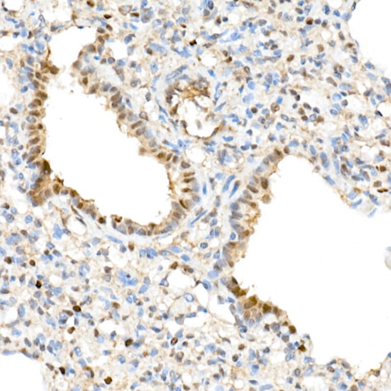 Immunohistochemistry - Anti-TAZ Antibody (A16113) - Antibodies.com