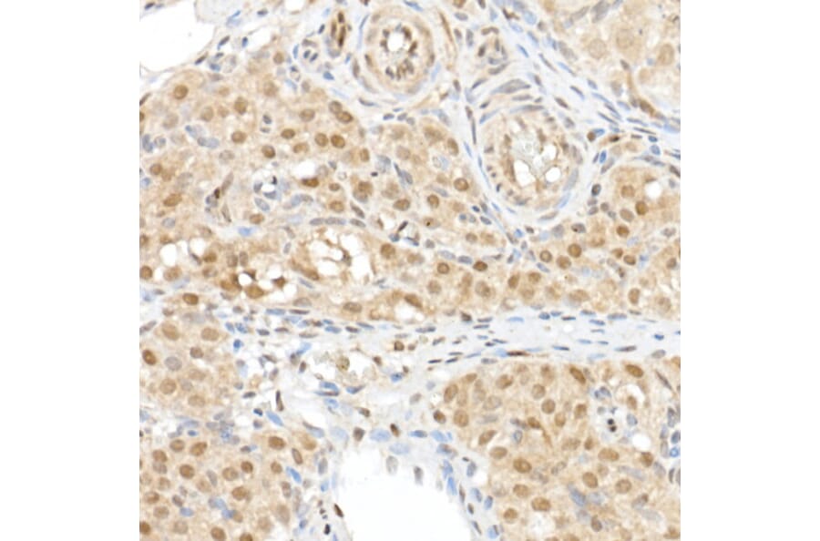 Immunohistochemistry - Anti-TAZ Antibody (A16113) - Antibodies.com