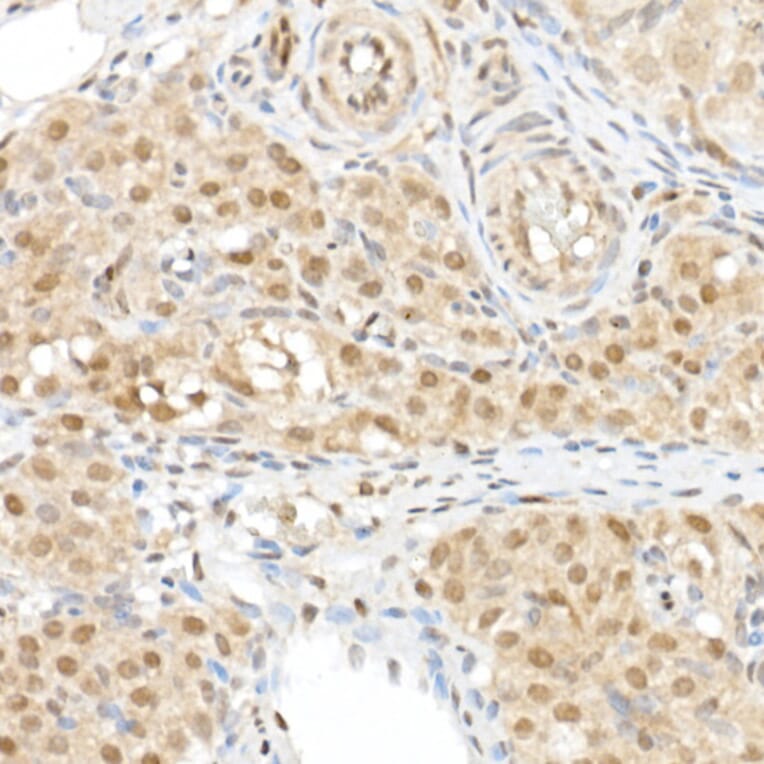 Immunohistochemistry - Anti-TAZ Antibody (A16113) - Antibodies.com