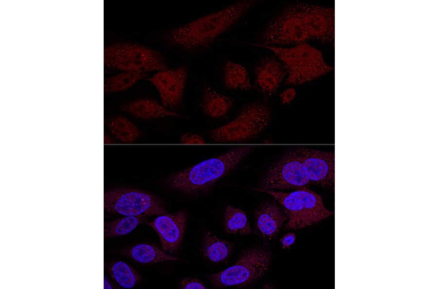 Immunofluorescence - Anti-TAZ Antibody (A16113) - Antibodies.com