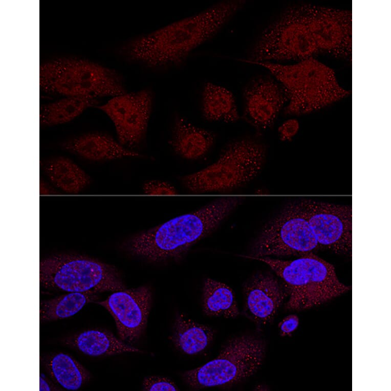 Immunofluorescence - Anti-TAZ Antibody (A16113) - Antibodies.com