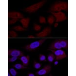 Immunofluorescence - Anti-TAZ Antibody (A16113) - Antibodies.com