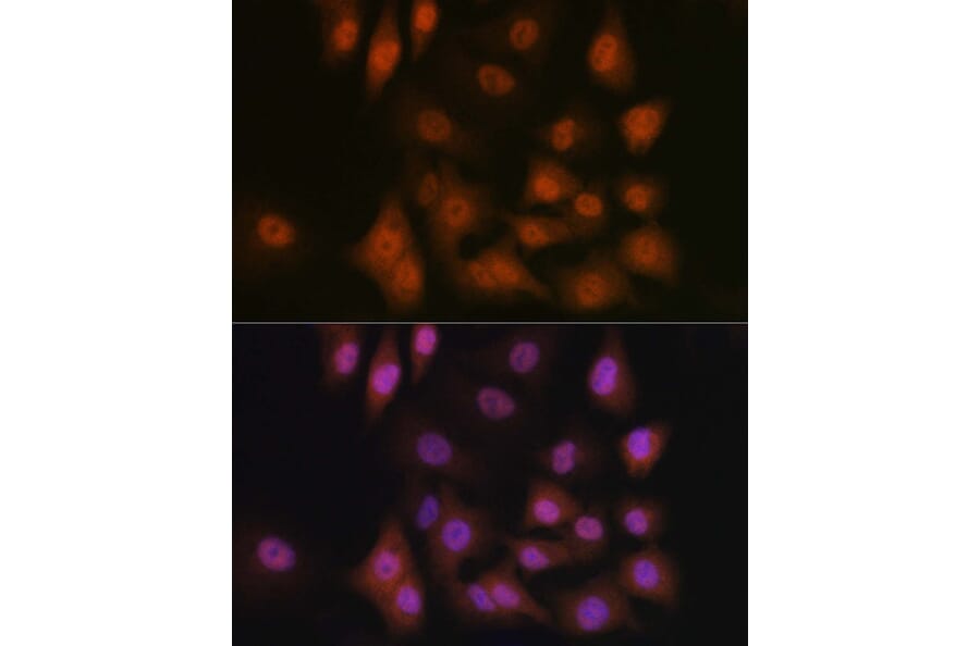 Immunofluorescence - Anti-TAZ Antibody (A16113) - Antibodies.com