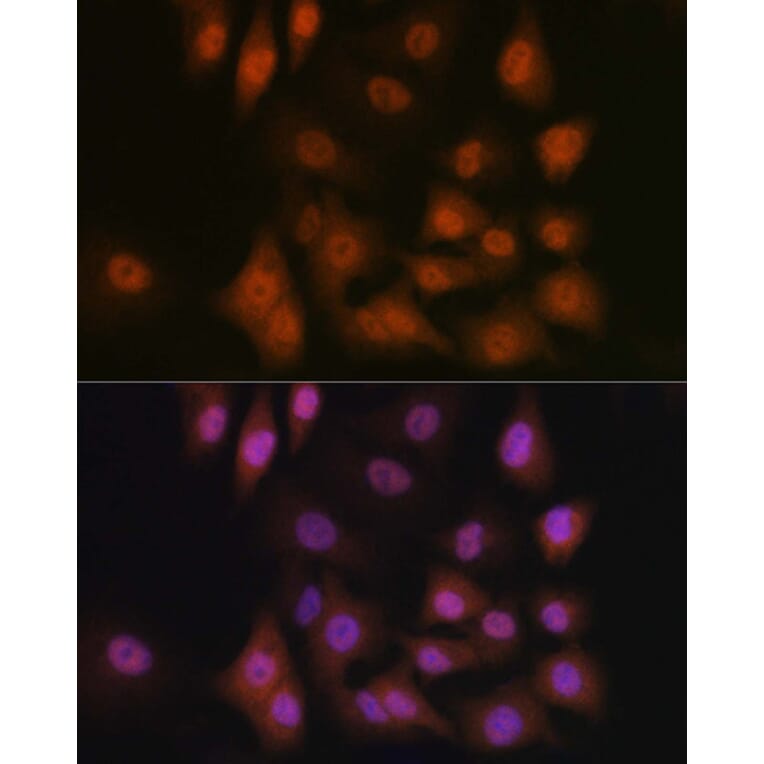 Immunofluorescence - Anti-TAZ Antibody (A16113) - Antibodies.com