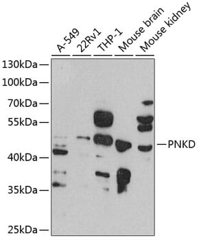 Western blot analysis of extracts of various cell lines, using Anti-PNKD Antibody (A8203) at 1:1,000 dilution.
Secondary antibody: Goat Anti-Rabbit IgG (H+L) (HRP) (AS014) at 1:10,000 dilution.
Lysates / proteins: 25µg per lane.
Blocking buffer: 3% non-fat dry milk in TBST.
Detection: ECL Basic Kit (RM00020).
Exposure time: 90s.