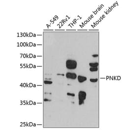 Western Blot - Anti-PNKD Antibody (A16114) - Antibodies.com