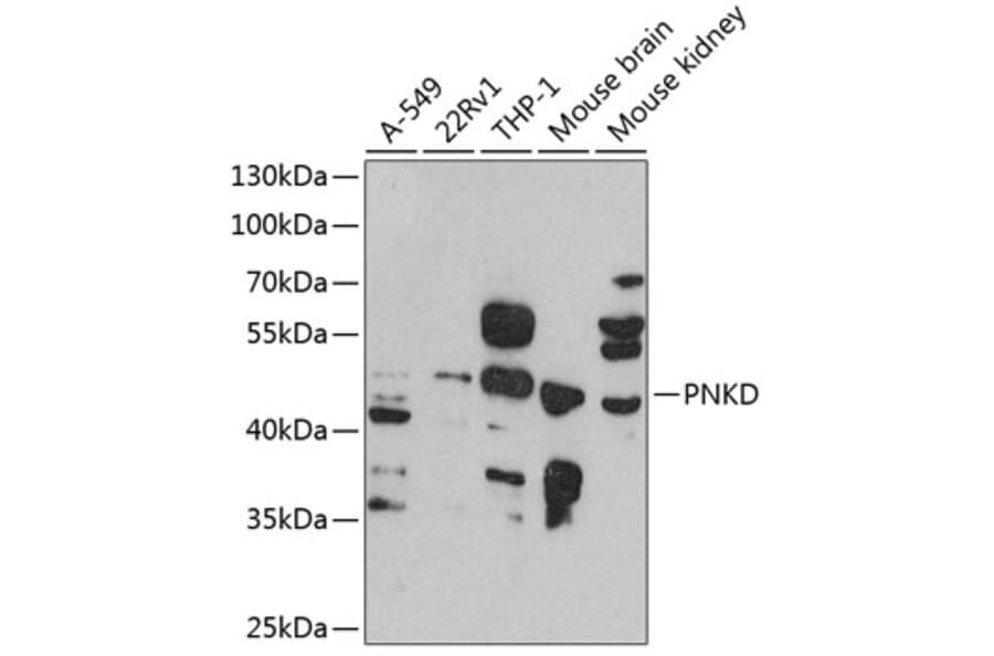 Western Blot - Anti-PNKD Antibody (A16114) - Antibodies.com