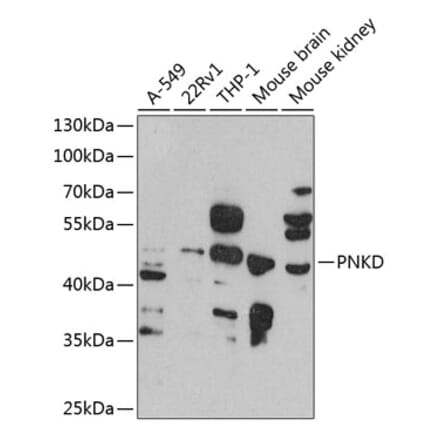 Western Blot - Anti-PNKD Antibody (A16114) - Antibodies.com