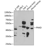 Western Blot - Anti-PNKD Antibody (A16114) - Antibodies.com