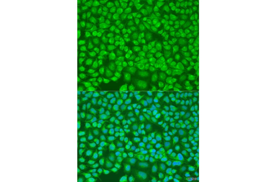 Immunofluorescence - Anti-PNKD Antibody (A16114) - Antibodies.com