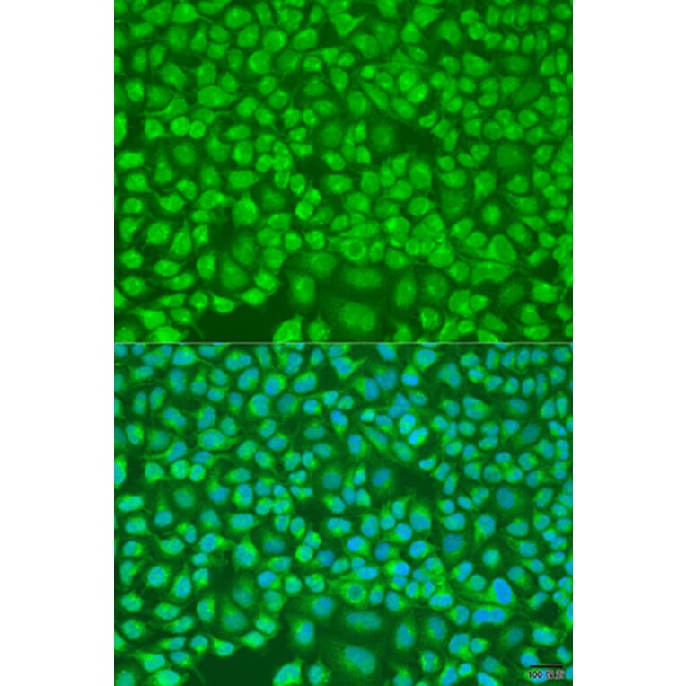 Immunofluorescence - Anti-PNKD Antibody (A16114) - Antibodies.com