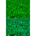 Immunofluorescence - Anti-PNKD Antibody (A16114) - Antibodies.com