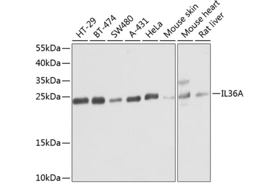 Western Blot - Anti-IL36 alpha/IL-1F6 Antibody (A16115) - Antibodies.com