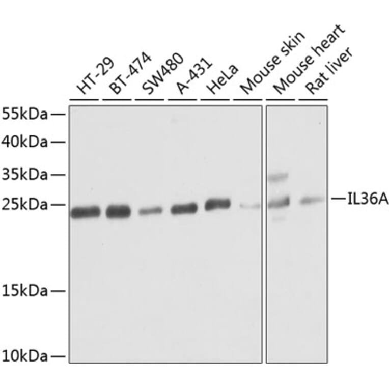 Western Blot - Anti-IL36 alpha/IL-1F6 Antibody (A16115) - Antibodies.com
