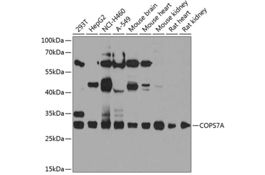 Western Blot - Anti-CSN7A Antibody (A16116) - Antibodies.com
