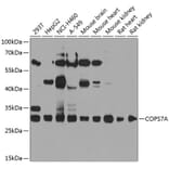 Western Blot - Anti-CSN7A Antibody (A16116) - Antibodies.com