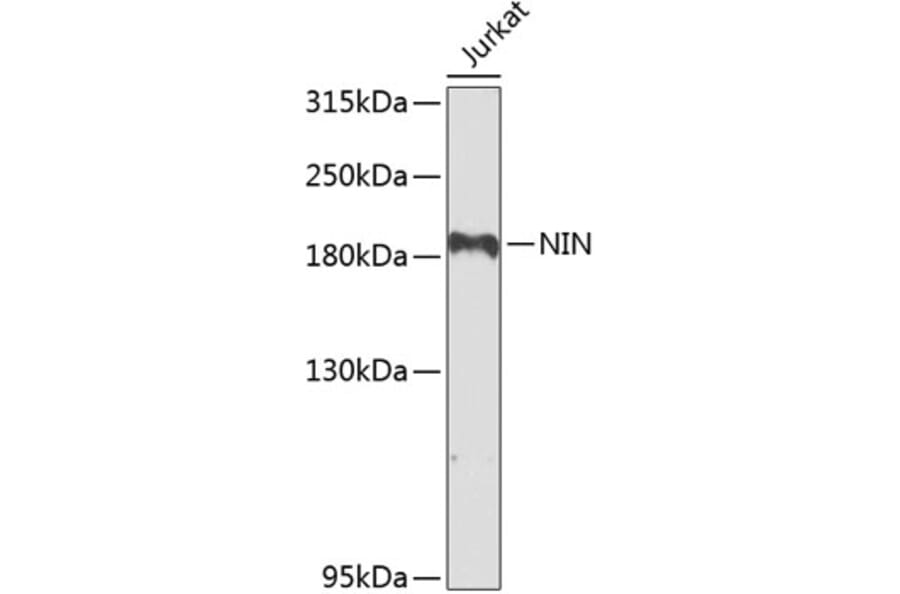 Western Blot - Anti-Ninein/NIN Antibody (A16118) - Antibodies.com