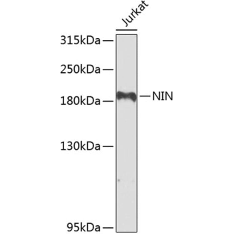 Western Blot - Anti-Ninein/NIN Antibody (A16118) - Antibodies.com