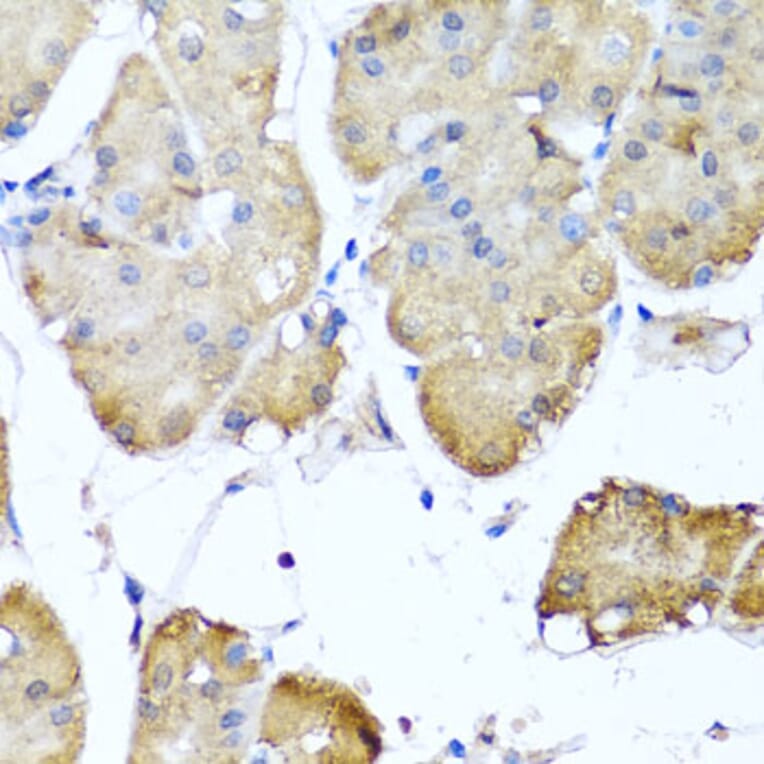 Immunohistochemistry - Anti-Ninein/NIN Antibody (A16118) - Antibodies.com
