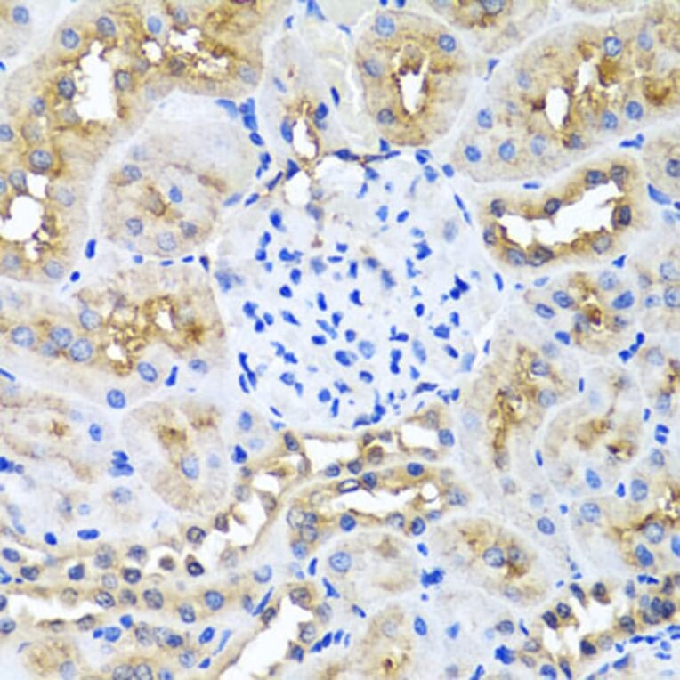 Immunohistochemistry - Anti-Ninein/NIN Antibody (A16118) - Antibodies.com