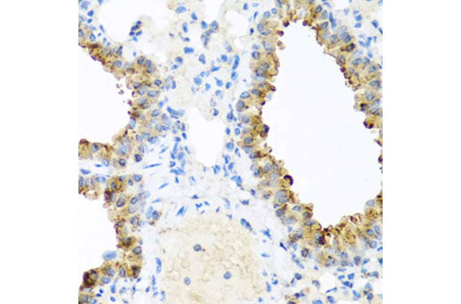 Immunohistochemistry - Anti-Ninein/NIN Antibody (A16118) - Antibodies.com