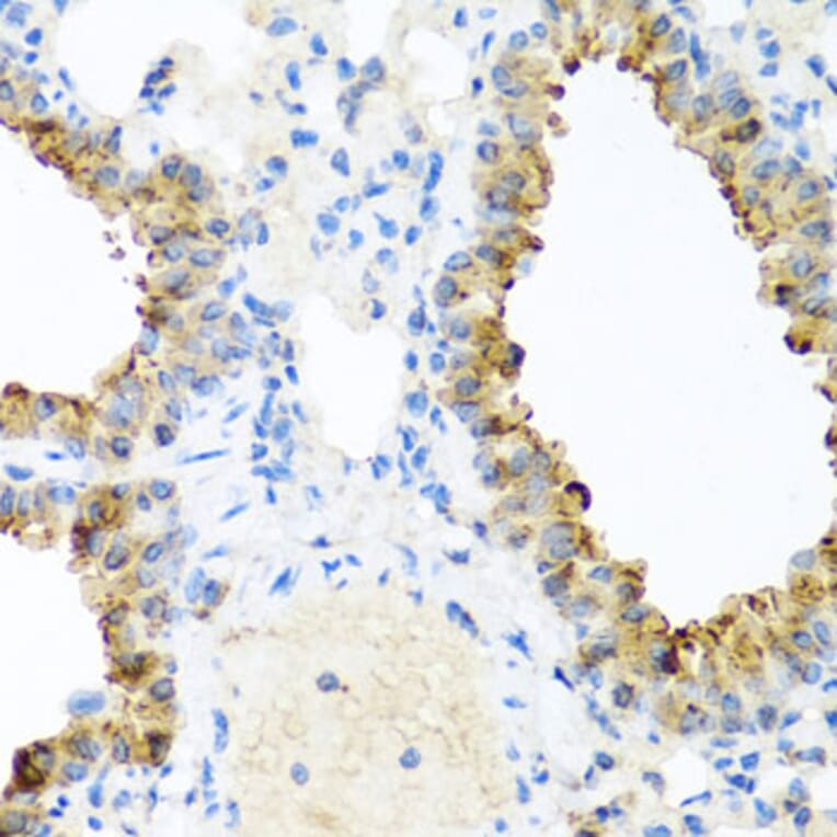 Immunohistochemistry - Anti-Ninein/NIN Antibody (A16118) - Antibodies.com
