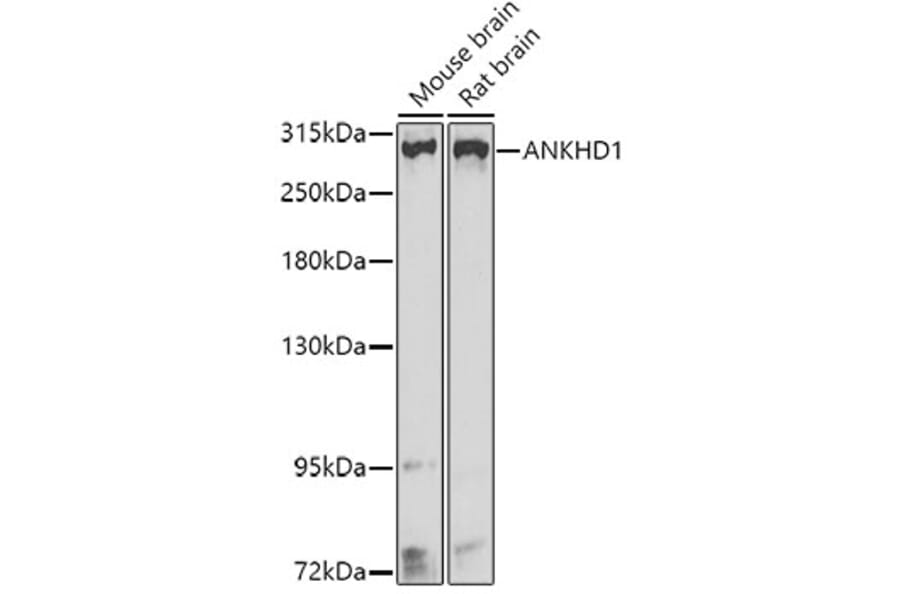 Western Blot - Anti-ANKHD1 Antibody (A16119) - Antibodies.com