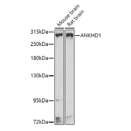 Western Blot - Anti-ANKHD1 Antibody (A16119) - Antibodies.com