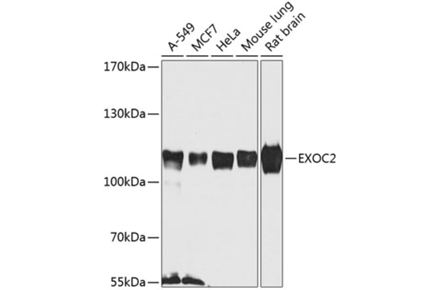 Western Blot - Anti-EXOC2 Antibody (A8235) - Antibodies.com