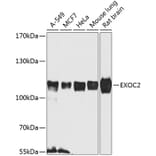 Western Blot - Anti-EXOC2 Antibody (A8235) - Antibodies.com